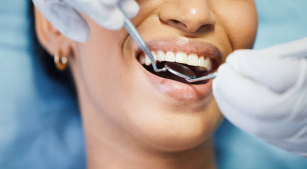 Best After-Hours Dental Care in Camas, WA